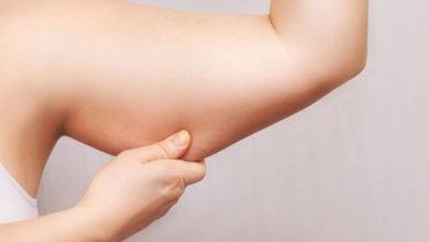 Photo of What Are The Causes Of Arms Fat? | Causes And Common Ways To Lose It
