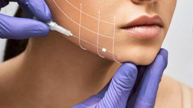 Photo of Facelift Surgery: A Comprehensive Guide